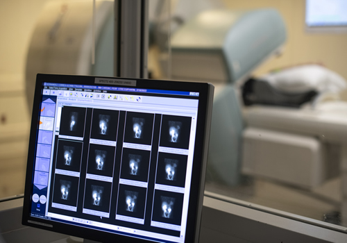 Musculoskeletal xray images on a computer screen.